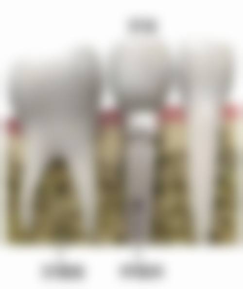 浙江温州平阳郑庆贺口腔核心项目