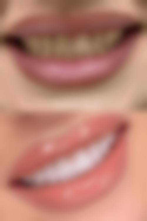 云南西双版纳景洪柏德口腔实例参考