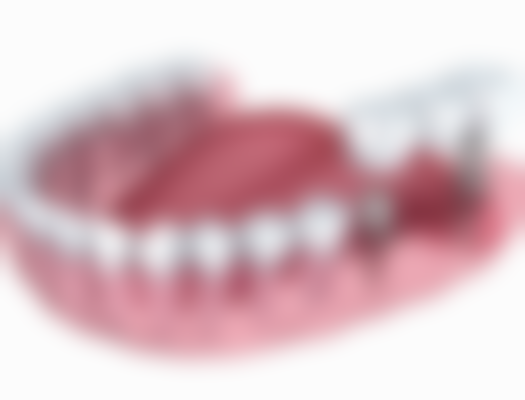 汕头爱雅口腔门诊核心项目