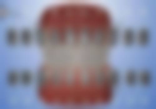 武汉虎泉口腔价格表(仅供参考)