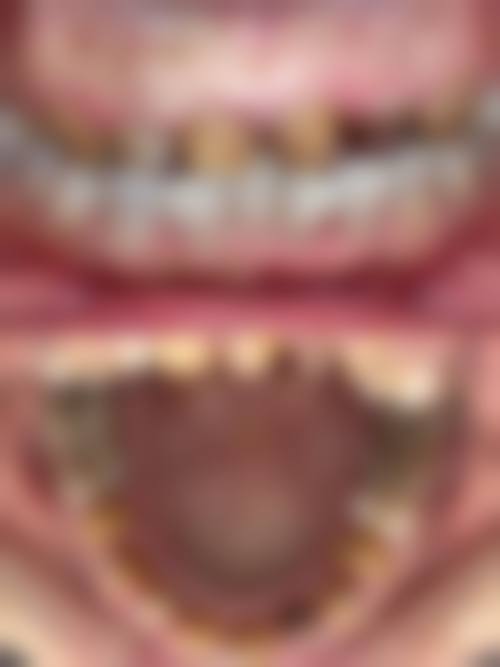 东莞万江诺德口腔门诊部价格表（仅供参考）