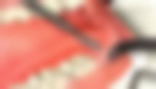 安徽安庆贝尔宿松口腔门诊核心项目