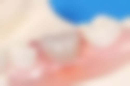 上海佳技口腔价格参考