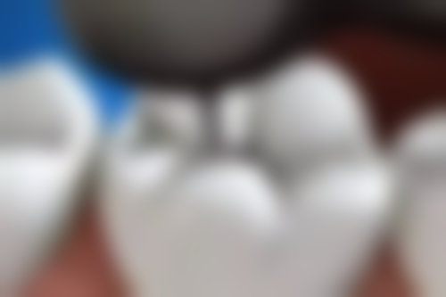 内蒙古呼伦贝尔宫丽口腔门诊怎么预约？