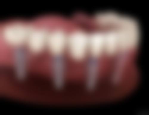 成都金牛洞子口幼麟华美口腔价格表(仅供参考)