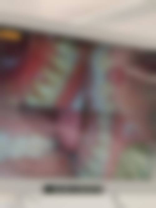 苏州家齿口腔·俞春霞口腔(浒关惠丰店)实例参考