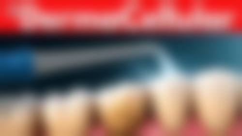 河北石家庄赵县赵勇口腔核心项目