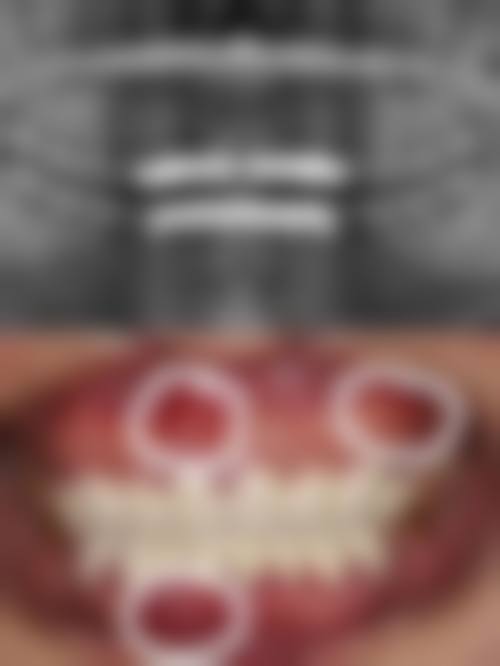 河北石家庄赵县赵勇口腔价格表(仅供参考)