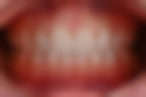 泰安肥城宫兆宇口腔诊所价格表(仅供参考)