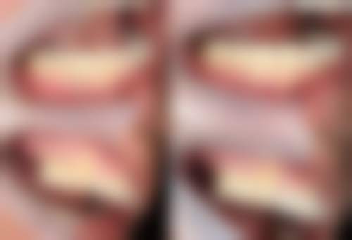 巩义市小白象口腔门诊部怎么预约?