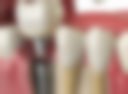 重庆城口众合口腔医生团队