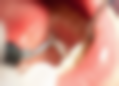 广东东莞邱伟文口腔实例参考