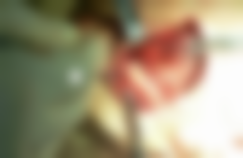 湖南长沙齿尔康口腔怎么预约？