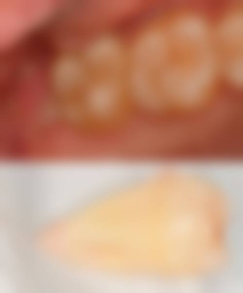 宝鸡洁雅士口腔怎么预约？