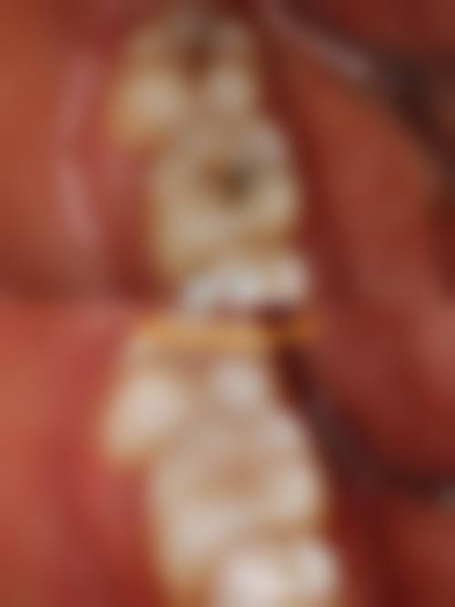 河南新乡儿时颗牙儿童口腔门诊怎么预约？