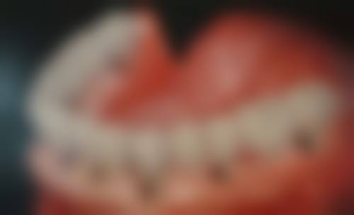 山东临沂罗庄益宏口腔诊所价格表（仅供参考）