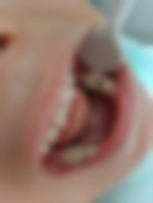 山东临沂罗庄益宏口腔诊所核心项目