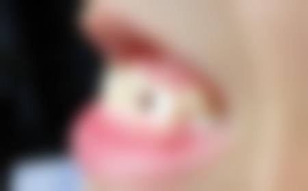 胡婷婷患者评价