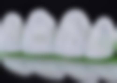 江西宜春奉新奥瑞口腔怎么预约？