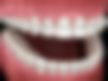 广东清远创美口腔实例参考