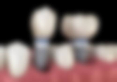 鼎植口腔医院价格表（仅供参考）