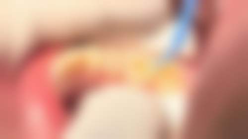 杭州萧山六月微笑口腔连锁实例参考