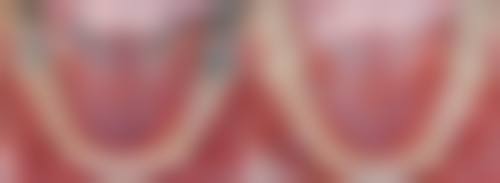 青岛大学附属医院口腔修复科正规吗?看资质