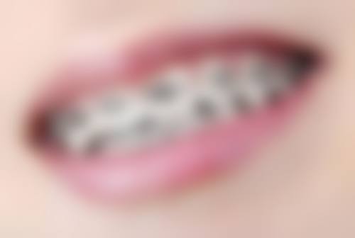 BCG朱锦博-(勿删)医生团队解析