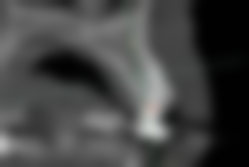 泸州江阳微笑口腔门诊部医生团队解析