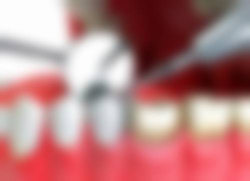 北京市宣武中医医院口腔科医生团队解析