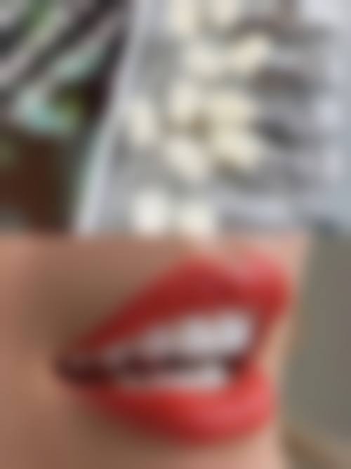 温州永嘉金建敏口腔医生团队解析