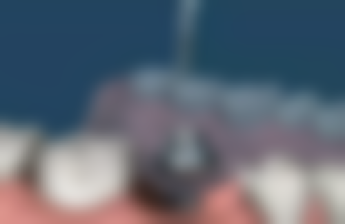 台州林泉口腔门诊2026价格表参考