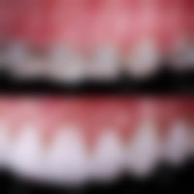 浙江杭州天鑫口腔2026价格表参考