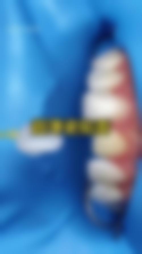 蓝天口腔医生团队解析