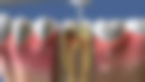 吉林市化工医院口腔科2026价格表参考