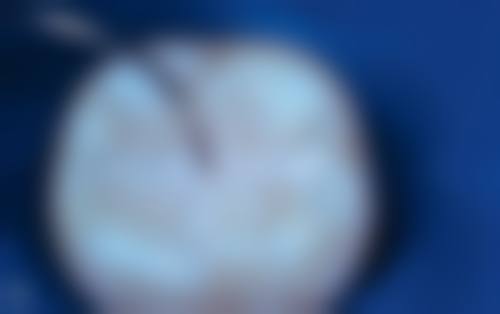 永州宁远牙总管口腔2026价格表参考