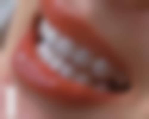 广东东莞谢岗黄伟口腔诊所口碑评价