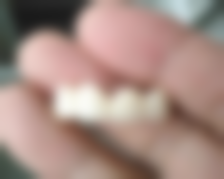 安庆贝尔口腔门诊部2026价格表参考