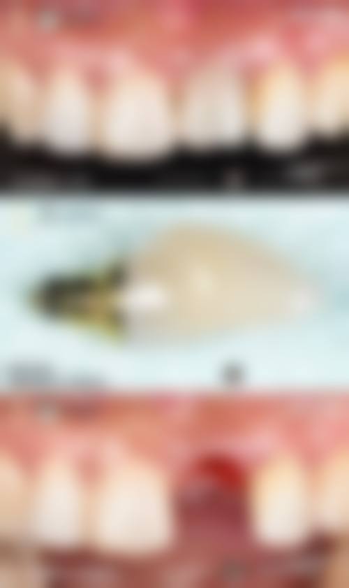 兔斯美丫沣东口腔医生团队解析