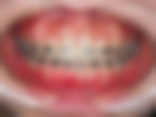 兔斯美丫沣东口腔擅长项目有哪些？