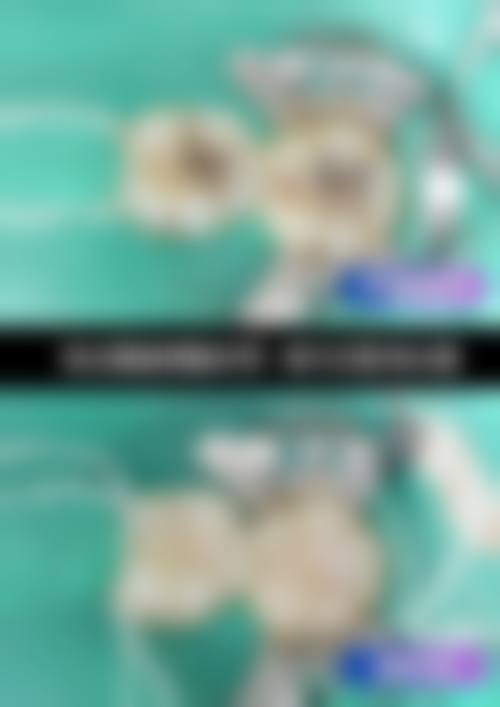 麻静(口腔医生)预约方式及价格表