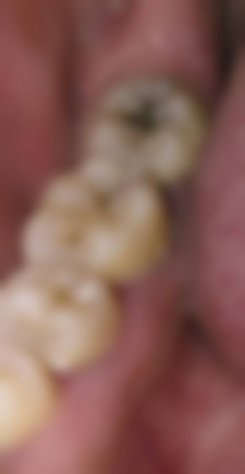 宜昌汪万年口腔门诊部2026价格表参考