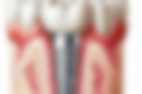 广东中山东峰口腔门诊口碑评价