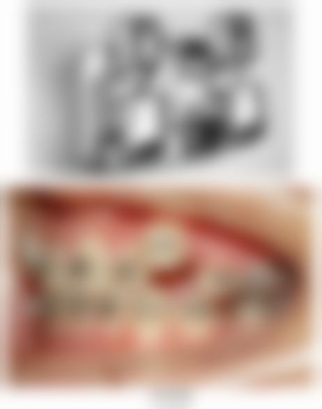 广东中山东峰口腔门诊擅长项目有哪些?