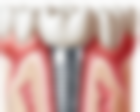 广东中山东峰口腔门诊2026价格表参考