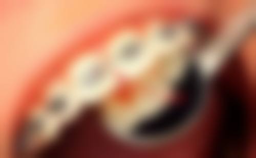 浙江湖州长兴慧仁口腔诊所2026价格表参考