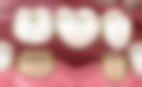 陈雅琦预约方式及价格表