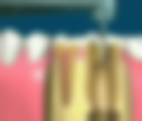 浙江湖州长兴贾伯秋口腔医生团队解析