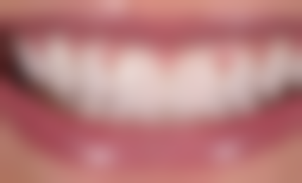 榆林红涛口腔医生团队解析