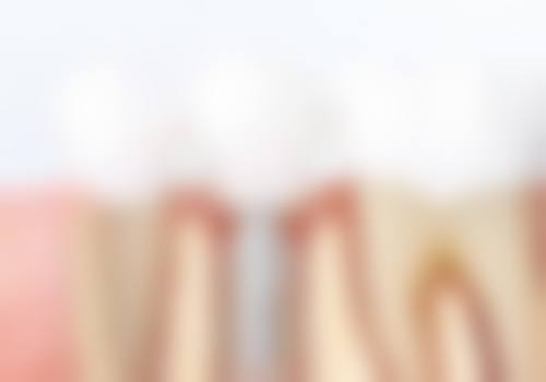 邳州汉亚口腔擅长项目有哪些？